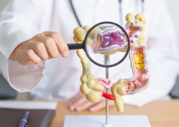 از کجا بفهمیم سندروم روده تحریک پذیر داریم؟