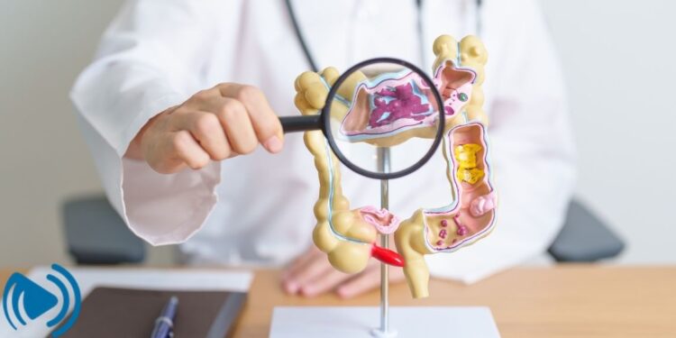 از کجا بفهمیم سندروم روده تحریک پذیر داریم؟