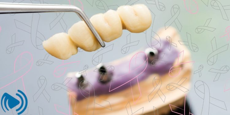 آیا ایمپلنت باعث سرطان میشود