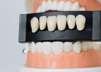 لمینت دندان چیست و چگونه انجام می_شود