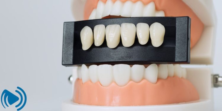 لمینت دندان چیست و چگونه انجام می_شود