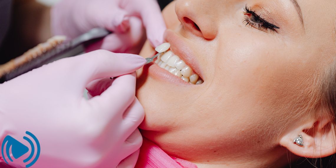 لمینت دندان چیست